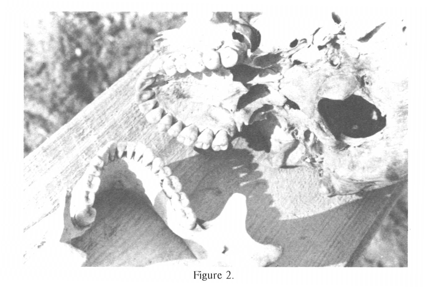 Set of Teeth