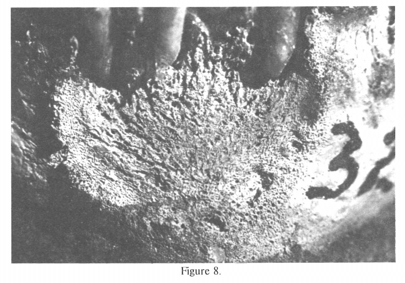 Skull with Lesion